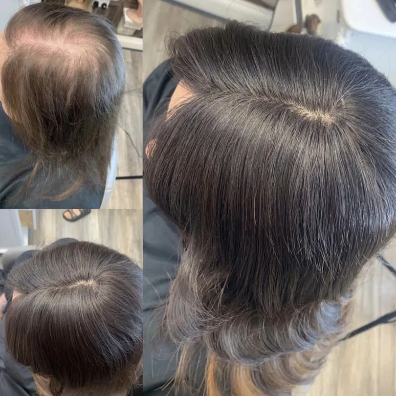 Dalgalı 15X16CM En İyi işlenmemiş insan saçı Topper Kadınlar için 2mc Pu Etrafında Çin peruk 5 Klipler Saç Topper İnce Postiş